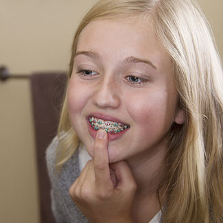 orthodontic faqs